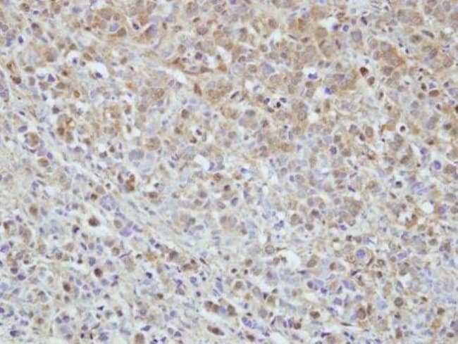 Anti-MPHOSPH6