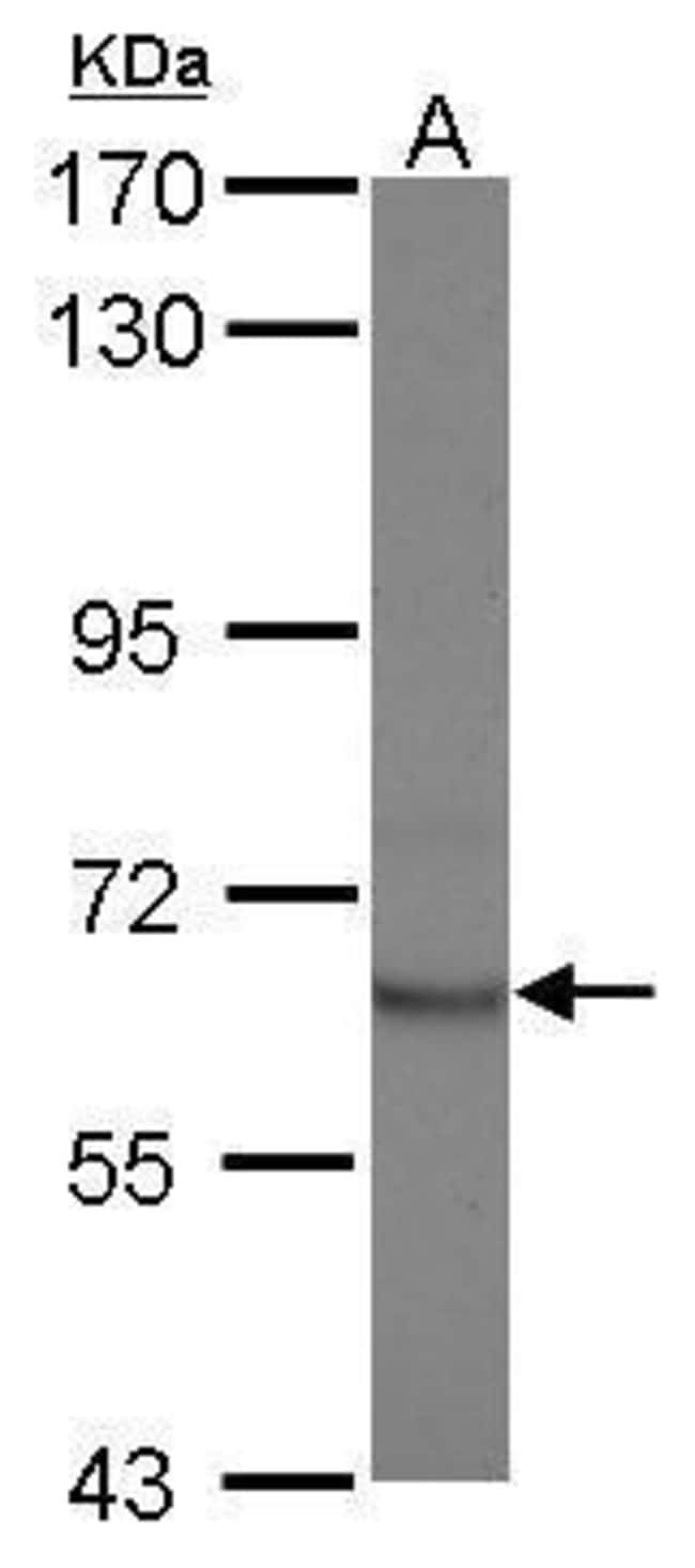 Anti-STAM2