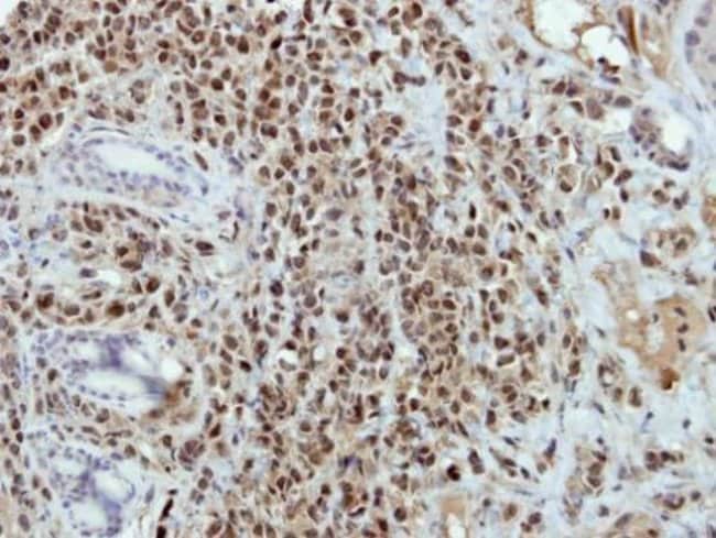 Anti-HMG20B