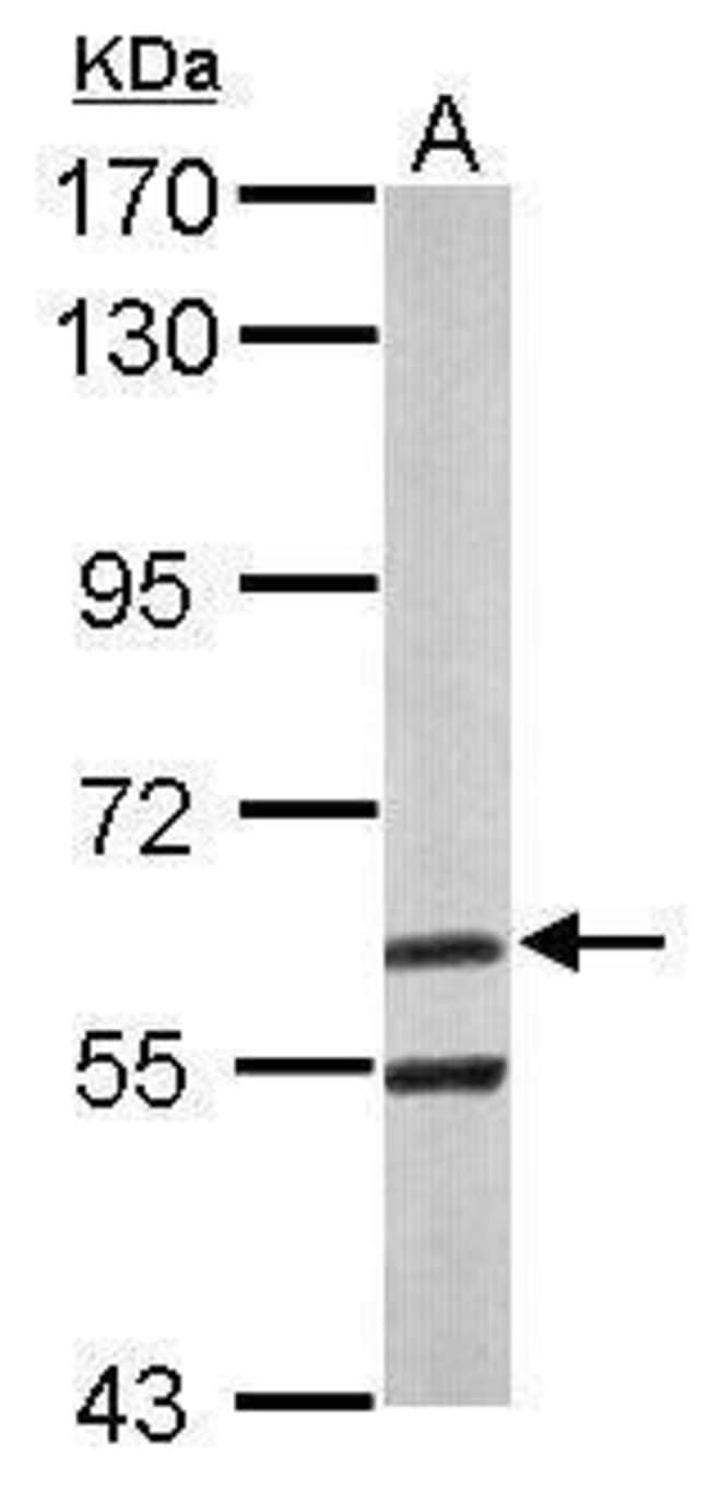Anti-ARIH2