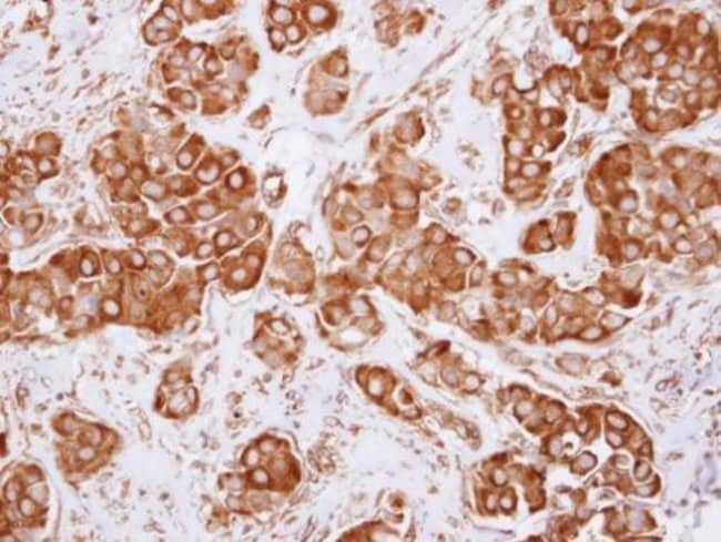 Anti-Dynactin 2