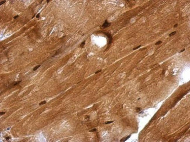 Anti-GMEB1