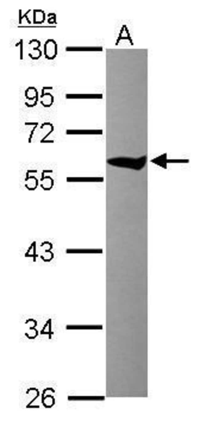 Anti-TCP1 theta
