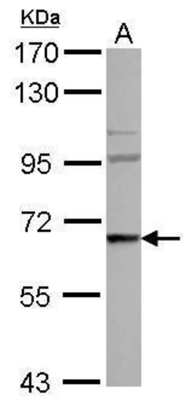 Anti-WASF3
