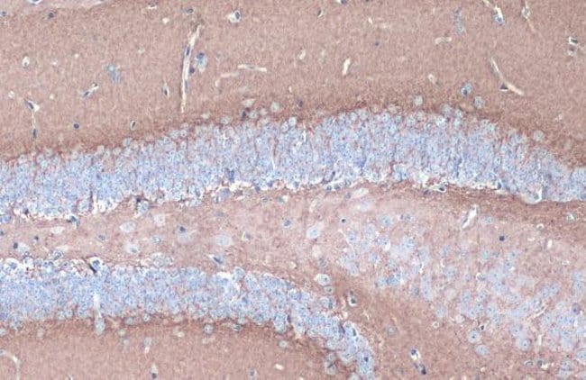 Anti-CYP46A1
