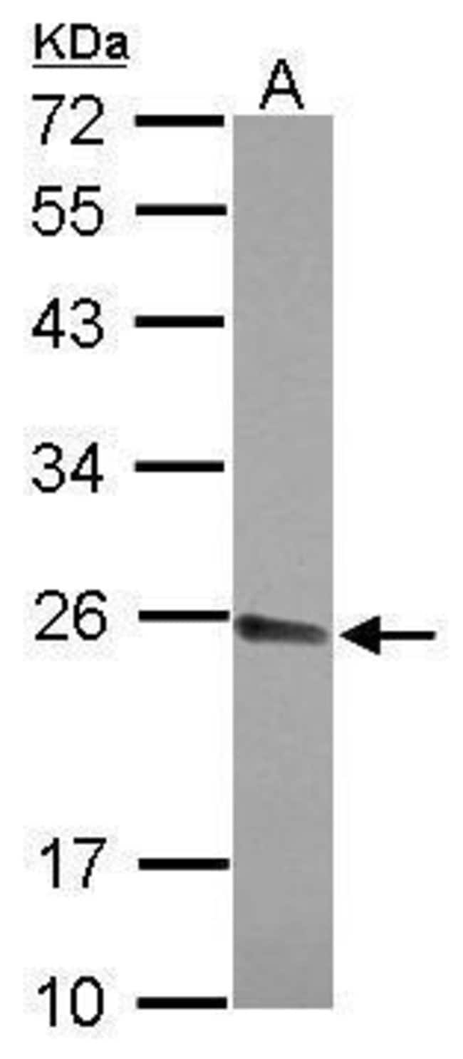 Anti-CPSF4
