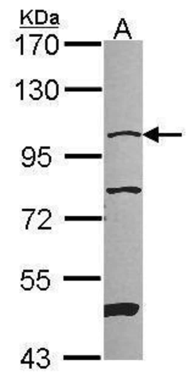 Anti-NARG1