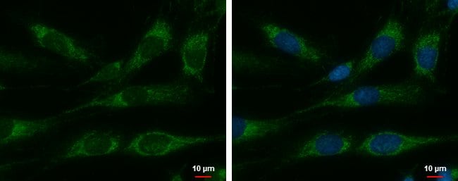 100UL HSPE1 Polyclonal Antibody, Invitro