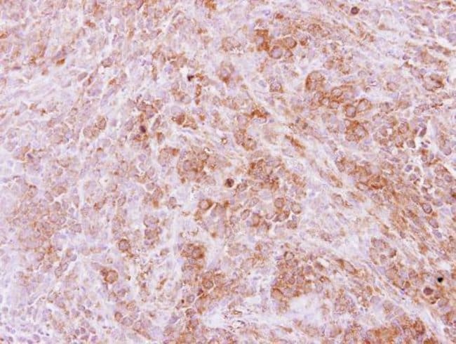 Anti-Calpain 11