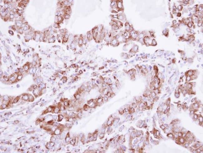 Anti-LDB3