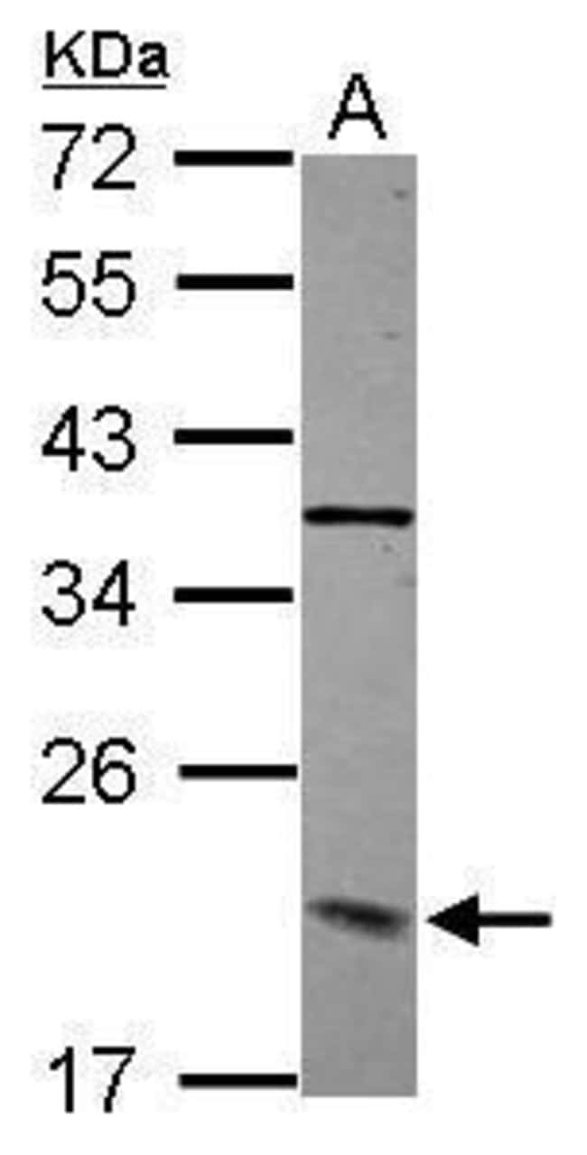 Anti-DCTN3