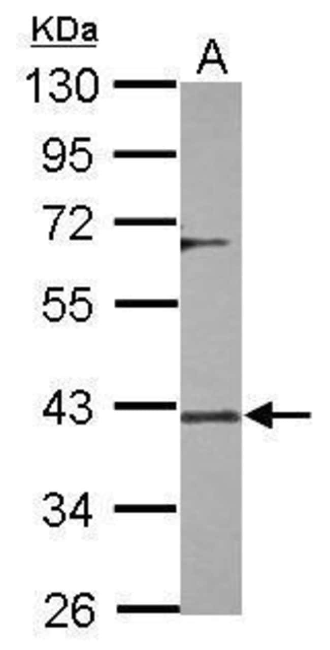 Anti-DUSP12