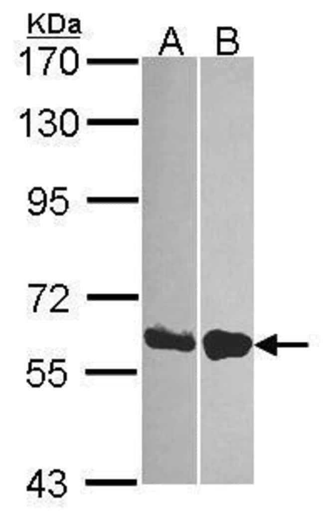 Anti-DDX19B