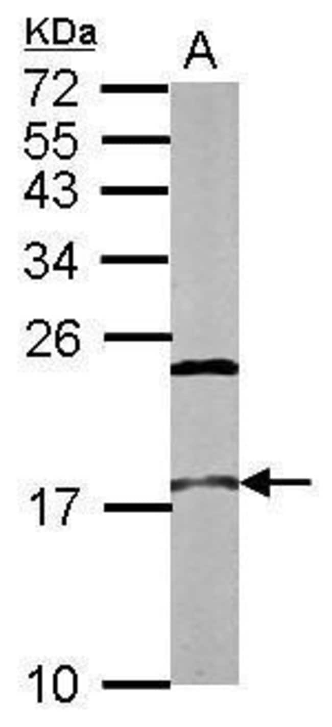Anti-NCBP2