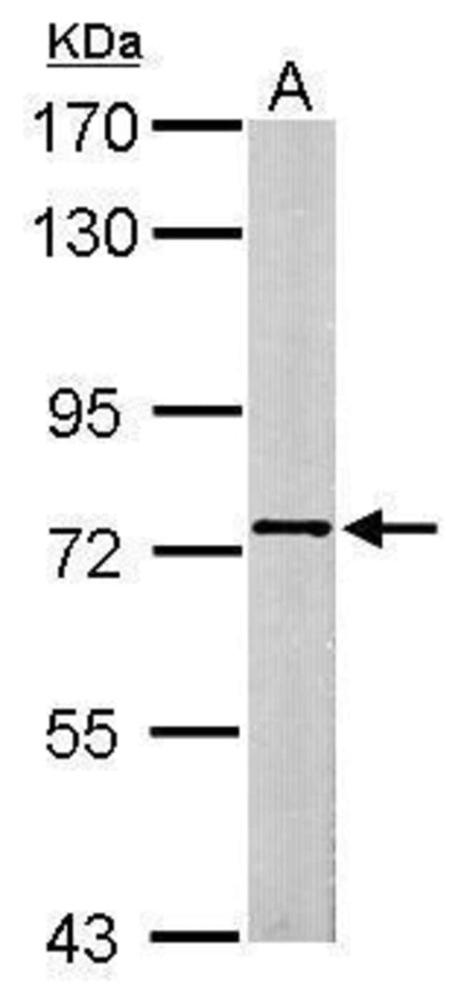 Anti-SCMH1