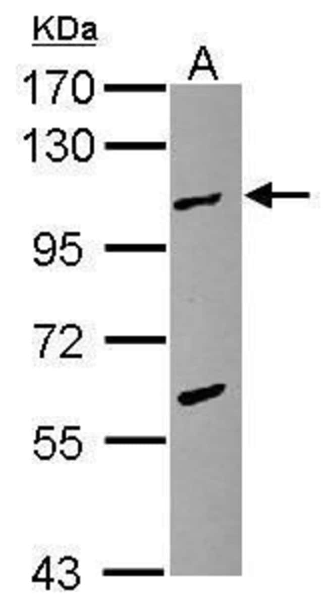 Anti-TPX2