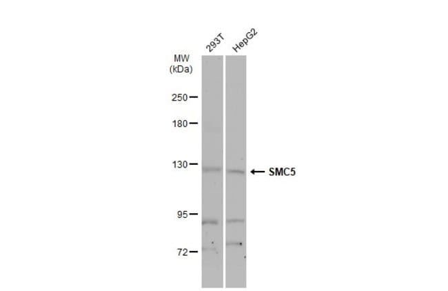 Anti-SMC5