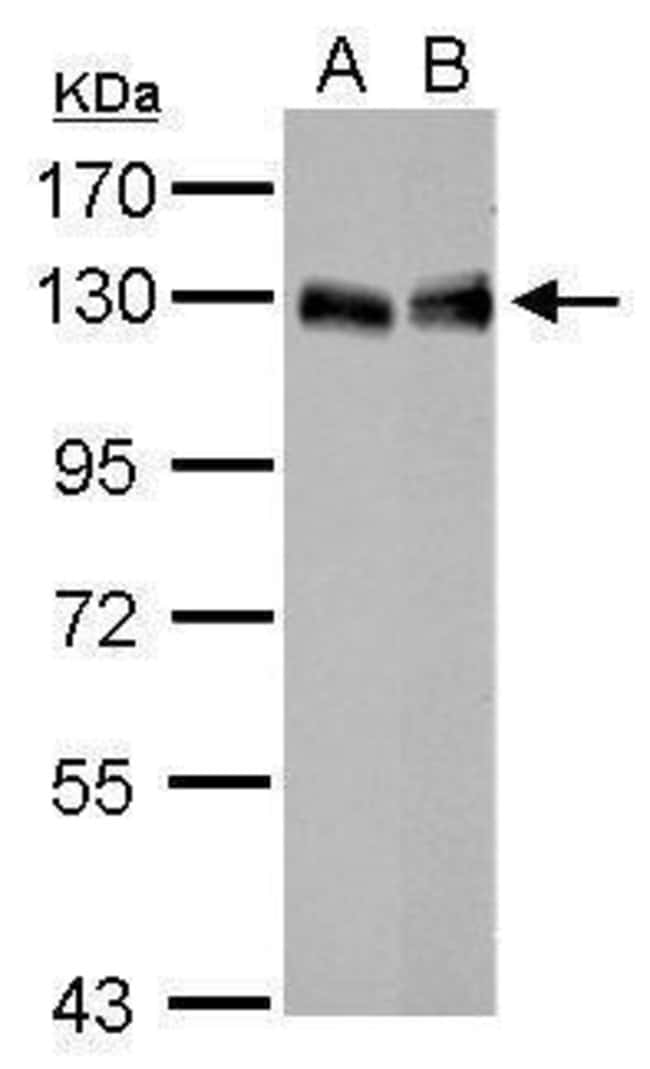 Anti-LPIN1