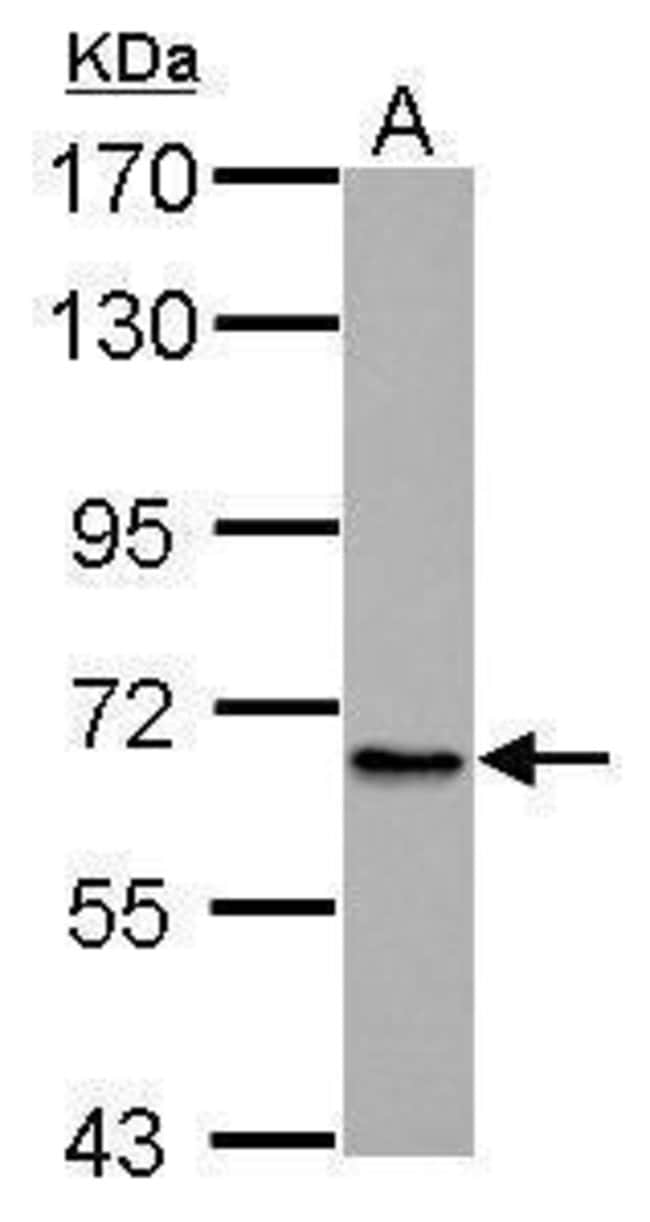 Anti-ABCB10
