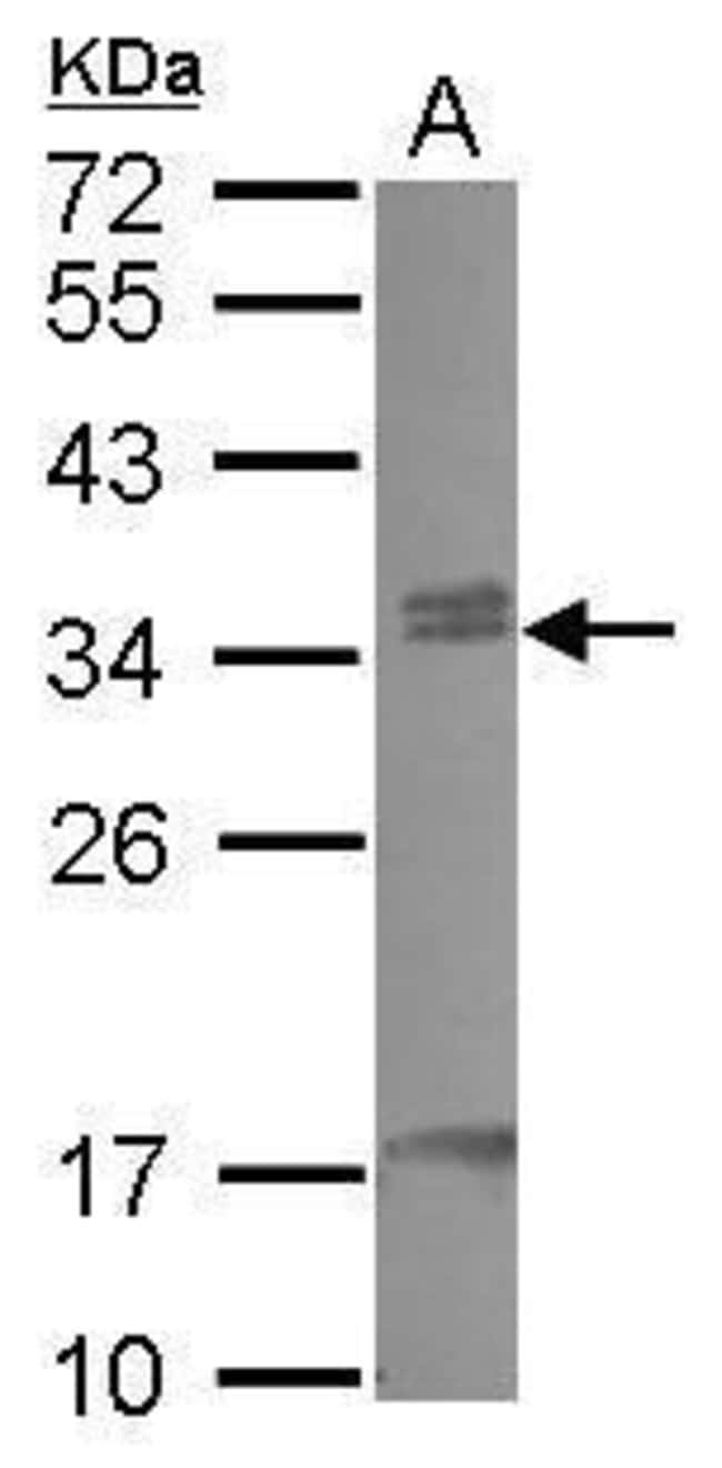 Anti-CBX7