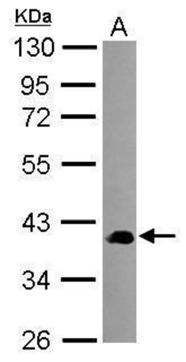 Anti-SEC14L2