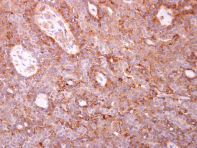 Anti-Coronin 1C