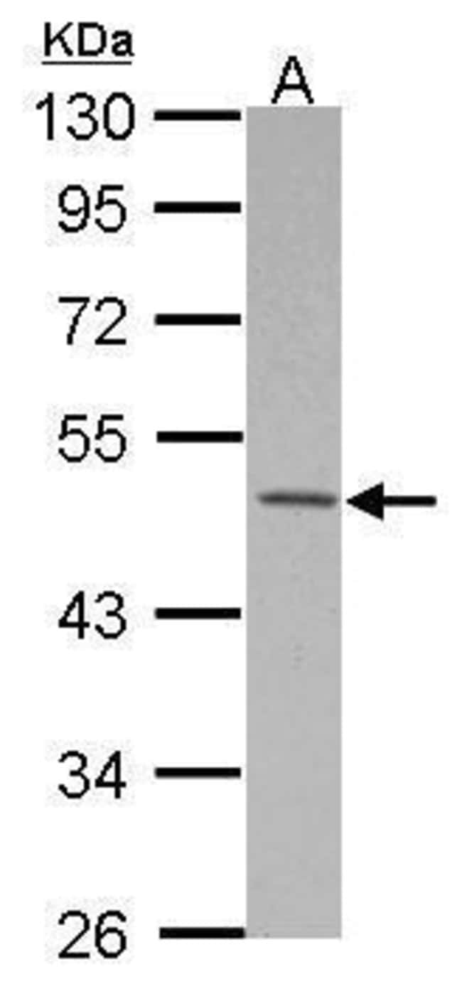 Anti-MKRN2