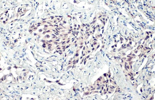 Anti-BRD1