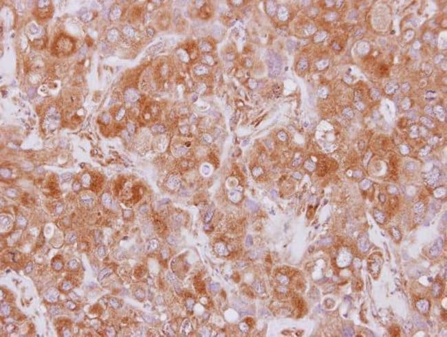 Anti-EML2