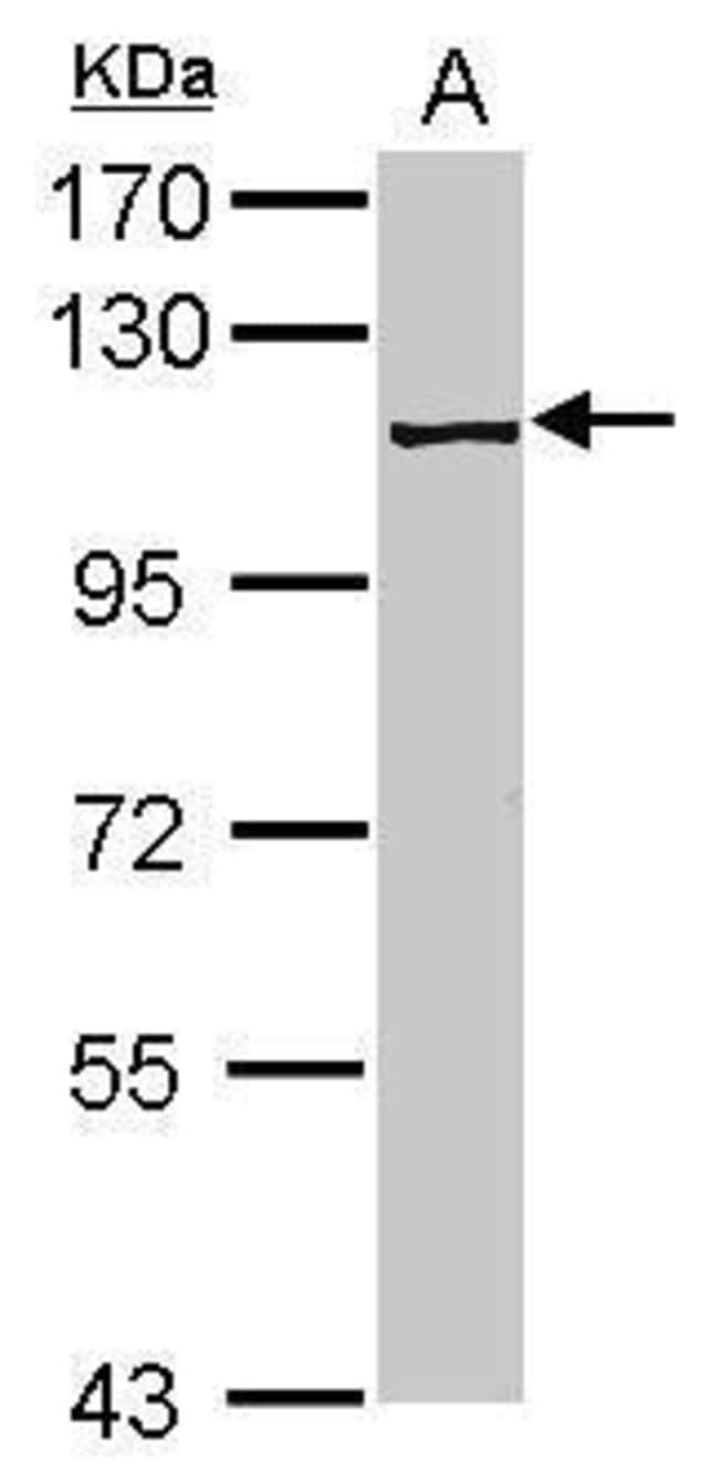 Anti-PRP6