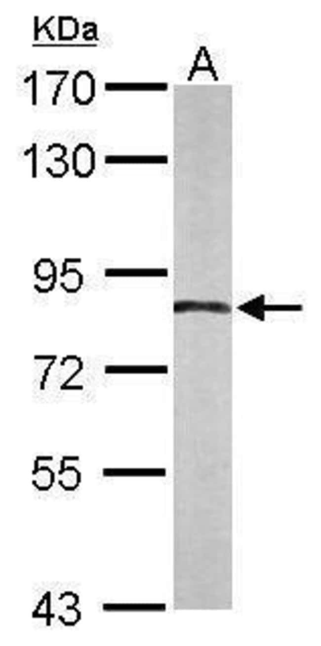 Anti-APPL1
