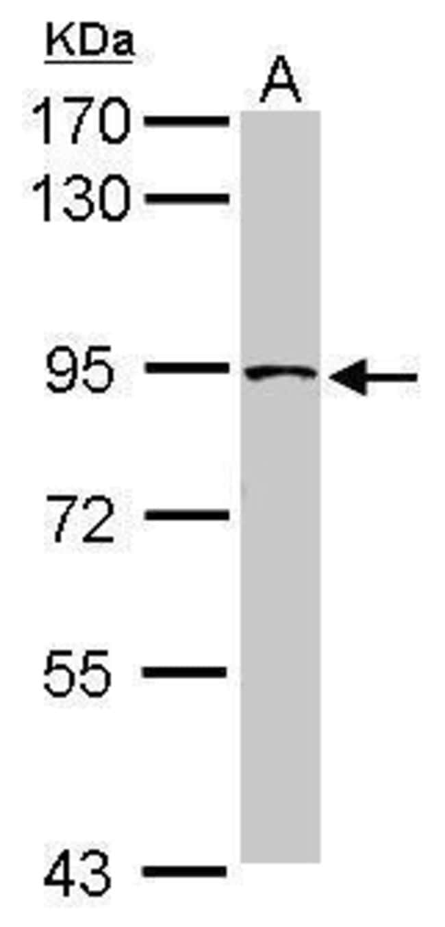 Anti-TRUSS