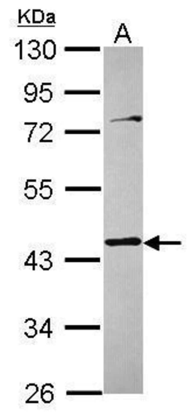 Anti-Tropomodulin 3