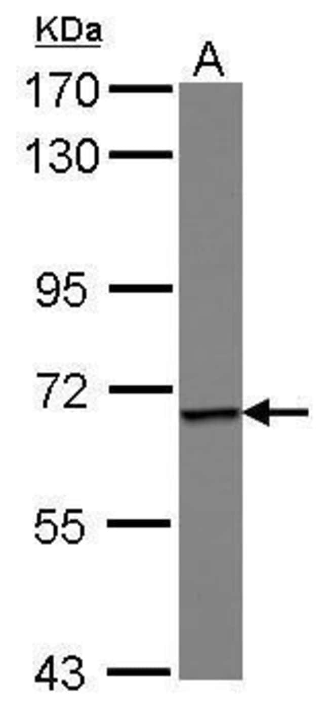 Anti-Epsin 1