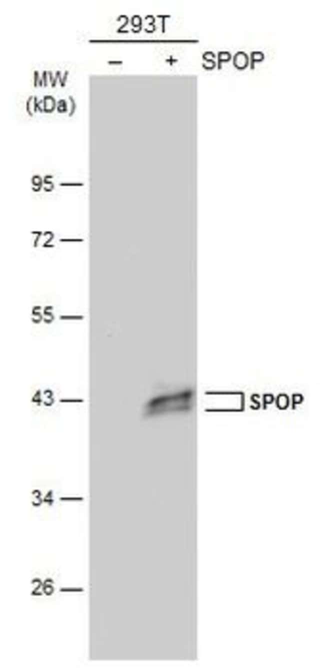 Anti-SPOP