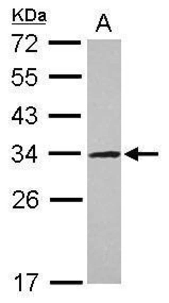 Anti-UTP11L