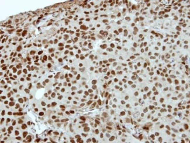 Anti-ZNF345