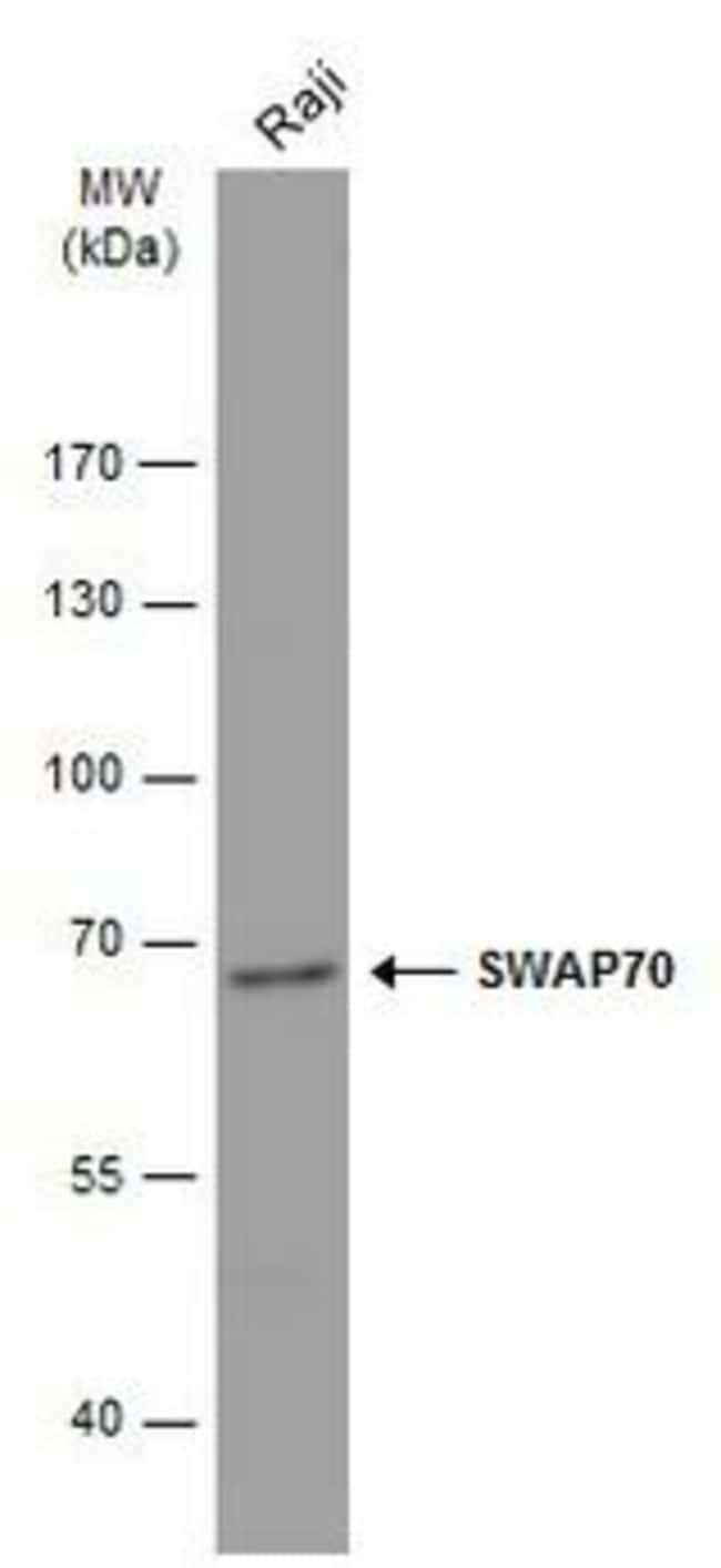Anti-SWAP70