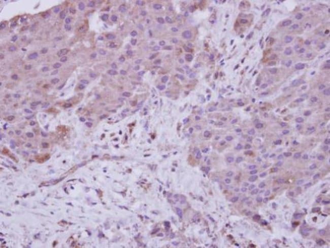 Anti-NARG1