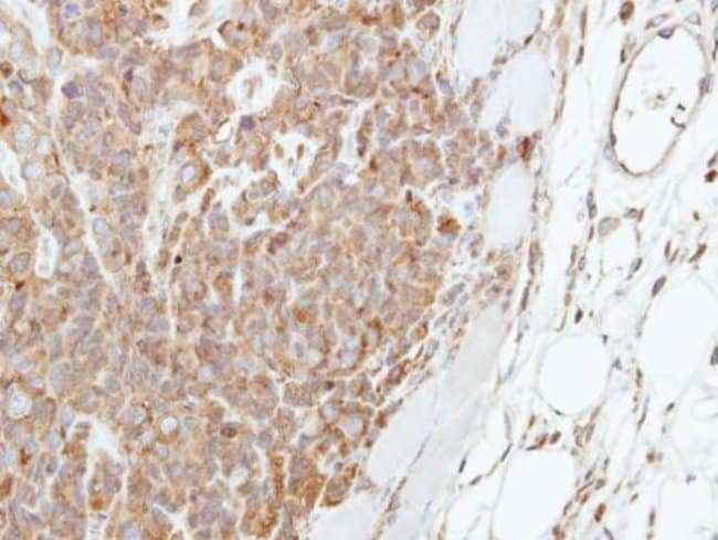 Anti-Involucrin
