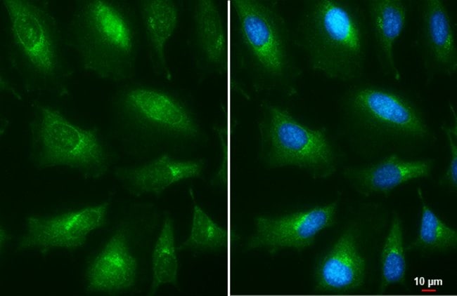Anti-Presenilin 1