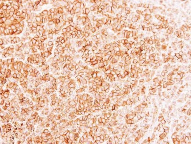 Anti-MRP1