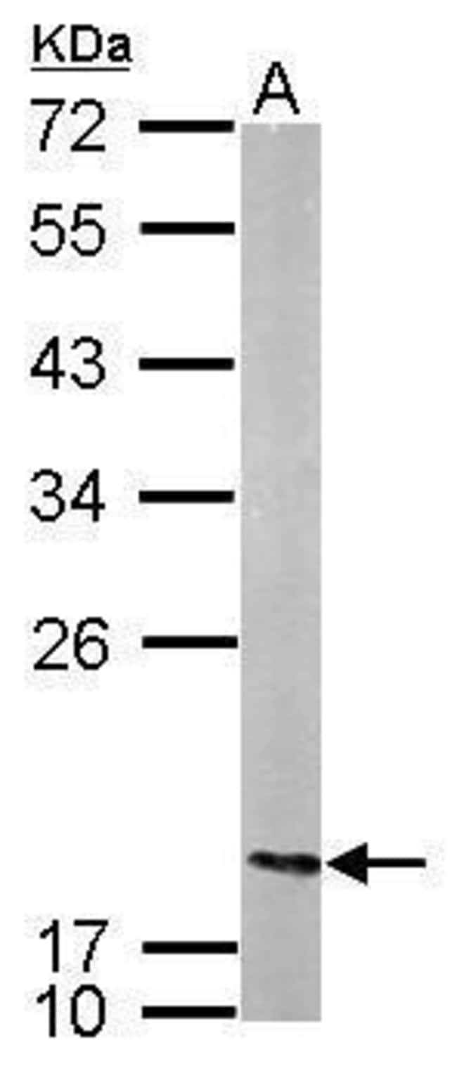 Anti-nm23-H2
