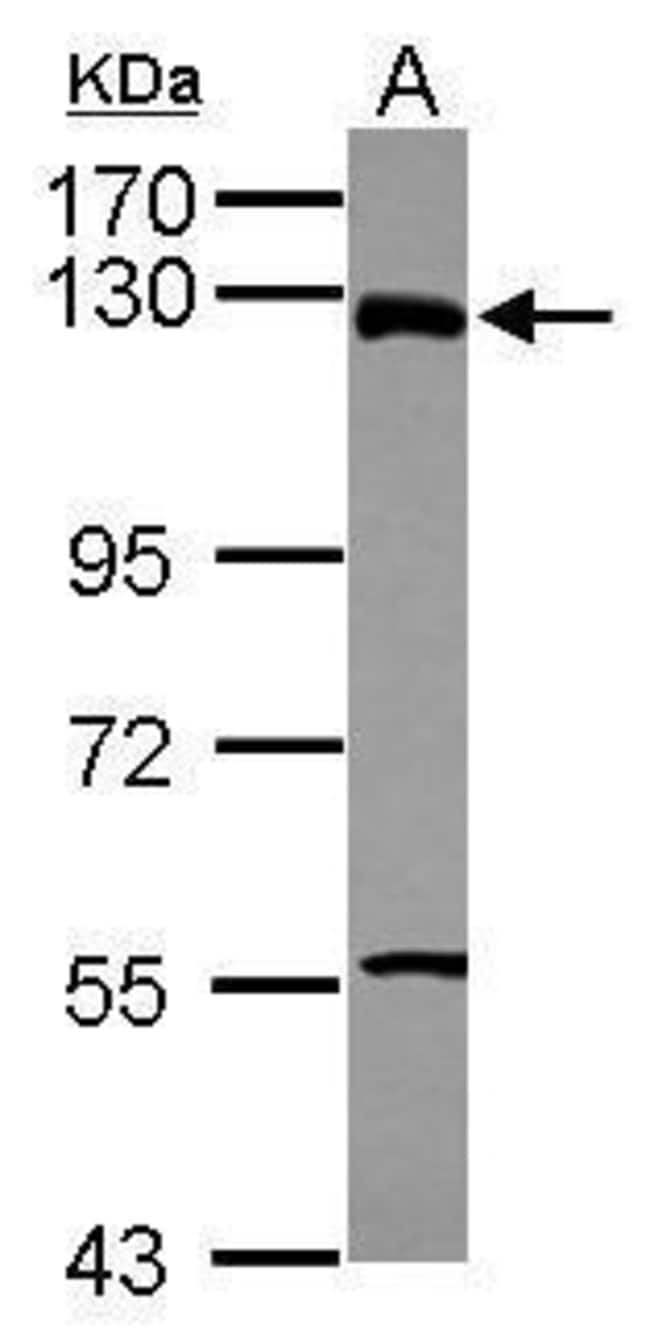 Anti-ZNF295
