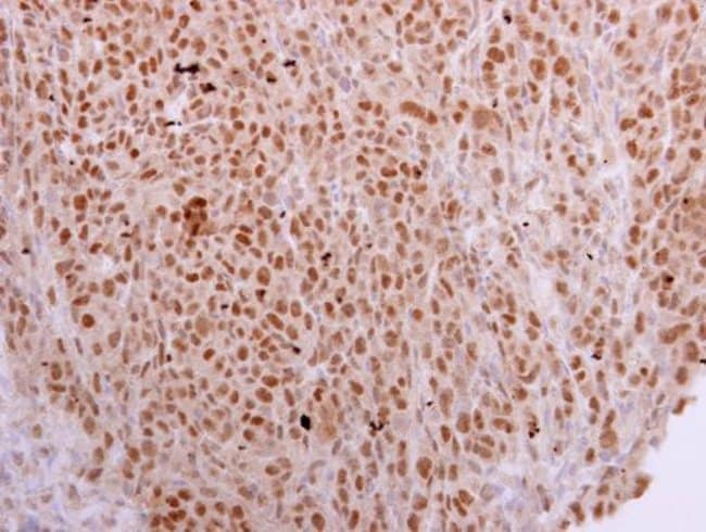 Anti-NOSIP