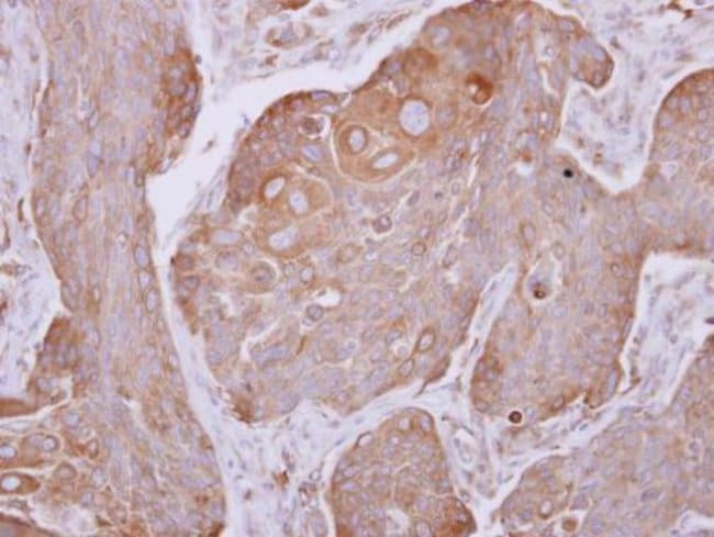 Anti-Dynactin p62
