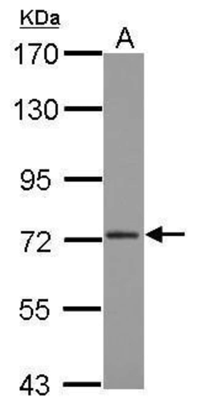 Anti-CPSF73