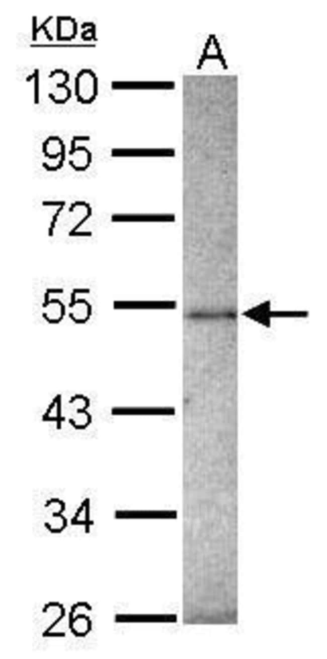 Anti-ZNF213