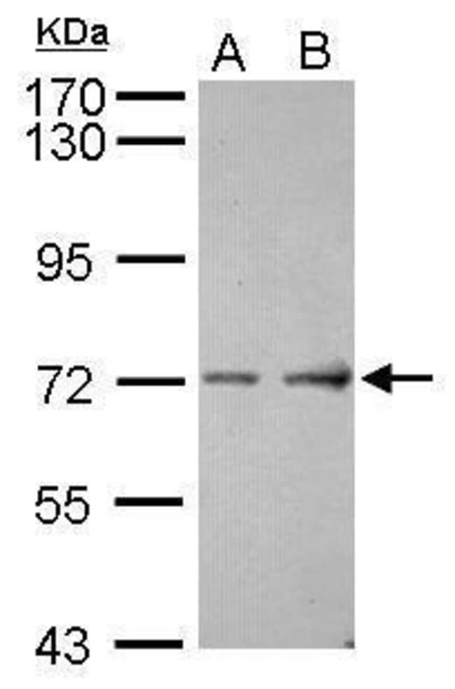 Anti-ACCN4