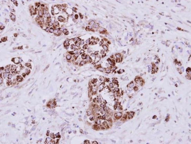 Anti-myo-inositol oxygenase